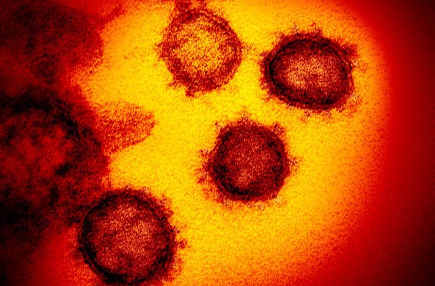  Brasil tem 1º resultado positivo para coronavírus