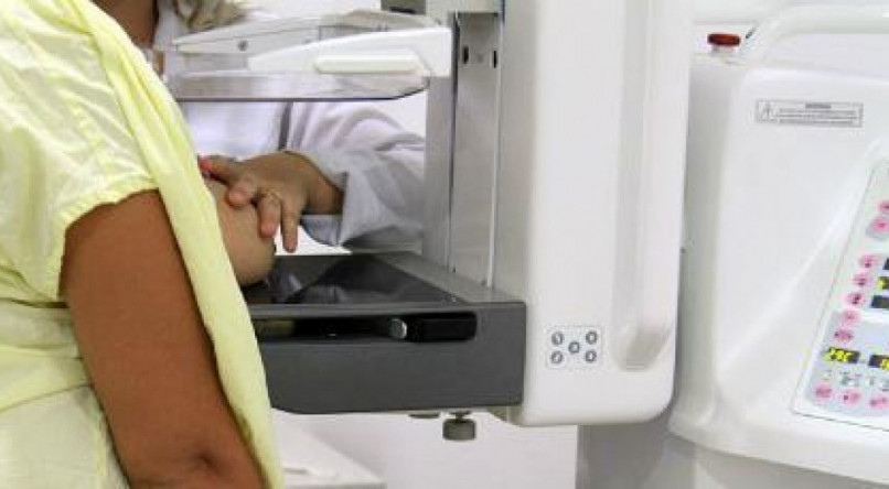  Pernambuco investe R$ 27 milhões para compra de 20 mamógrafos digitais, que vão triplicar capacidade de realização de exames