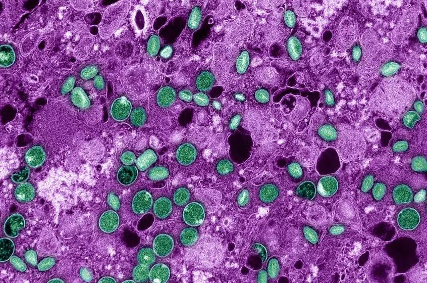  Mpox: 13 estados já confirmaram a doença; total de casos no país chega a 149